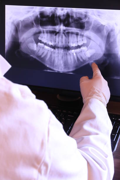 Best Emergency Tooth Extraction in Archdale, NC